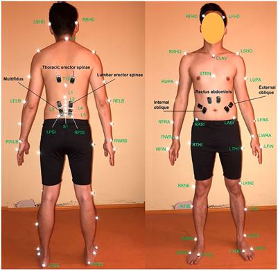 Sex-Dependent Estimation of Spinal Loads During Static Manual Material Handling Activities—Combined in vivo and in silico Analyses